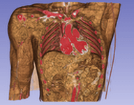 Cardiac CT imaging preview