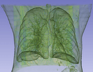 Lung CT imaging preview